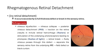 Rhegmatogenous Retinal Detachment
• (1ry retinal detachment)
It occurs secondarily to full thickness defect or break in the sensory retina.
Pathogenesis:
 vitreous liquefaction → vitreous collapse → posterior
vitreous detachm ent (PVD) → traction on the retina
(results in m inute retinal hem orrhage ( floaters) or
stim ulation of the underlying photoreceptors leading to
photopsia (flashes of light)) → retinal break → fluidy
vitreous passes through this defect → separate the
sensory retina from the underlying RPE → field defect or
black curtain.
 