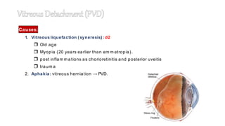 Causes:
1. Vitreous liquefaction (syneresis): d2
 Old age
 Myopia (20 years earlier than em m etropia).
 post inflam m ations as chorioretinitis and posterior uveitis
 traum a
2. Aphakia: vitreous herniation → PVD.
 