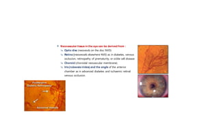  Neovascular tissue in the eye can be derived from :
 Optic disc (neovessls on the disc NVD)
 Retina (neovessels elsewhere NVE) as in diabetes, venous
occlusion, retinopathy of prematurity, or sickle cell disease
 Choroid (choroidal neovascular membrane).
 Iris(rubeosisirides) and the angle of the anterior
chamber as in advanced diabetes and ischaemic retinal
venous occlusion.
 
