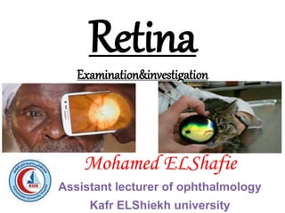 Retina
Examination&investigation
Mohamed ELShafie
Assistant lecturer of ophthalmology
Kafr ELShiekh university
 