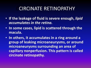 CCIRCINATE RETINOPATHY
• If the leakage of fluid is severe enough, lipid
accumulates in the retina.
• In some cases, lipid is scattered through the
macula.
• In others, it accumulates in a ring around a
group of leaking microaneurysms, or around
microaneurysms surrounding an area of
capillary nonperfusion. This pattern is called
circinate retinopathy.

 