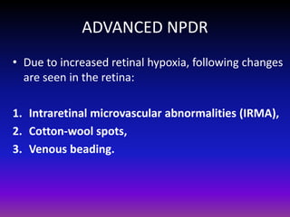 ADVANCED NPDR
• Due to increased retinal hypoxia, following changes
are seen in the retina:
1. Intraretinal microvascular abnormalities (IRMA),
2. Cotton-wool spots,
3. Venous beading.

 