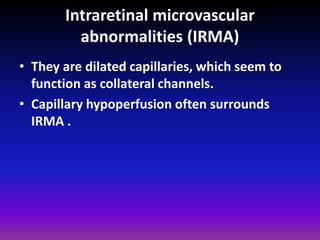 Intraretinal microvascular
abnormalities (IRMA)
• They are dilated capillaries, which seem to
function as collateral channels.
• Capillary hypoperfusion often surrounds
IRMA .

 
