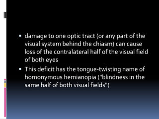 Visual Damage Retina and visual tract | PPTX