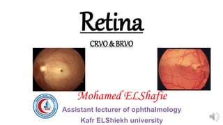 Retina
CRVO & BRVO
Mohamed ELShafie
Assistant lecturer of ophthalmology
Kafr ELShiekh university
 
