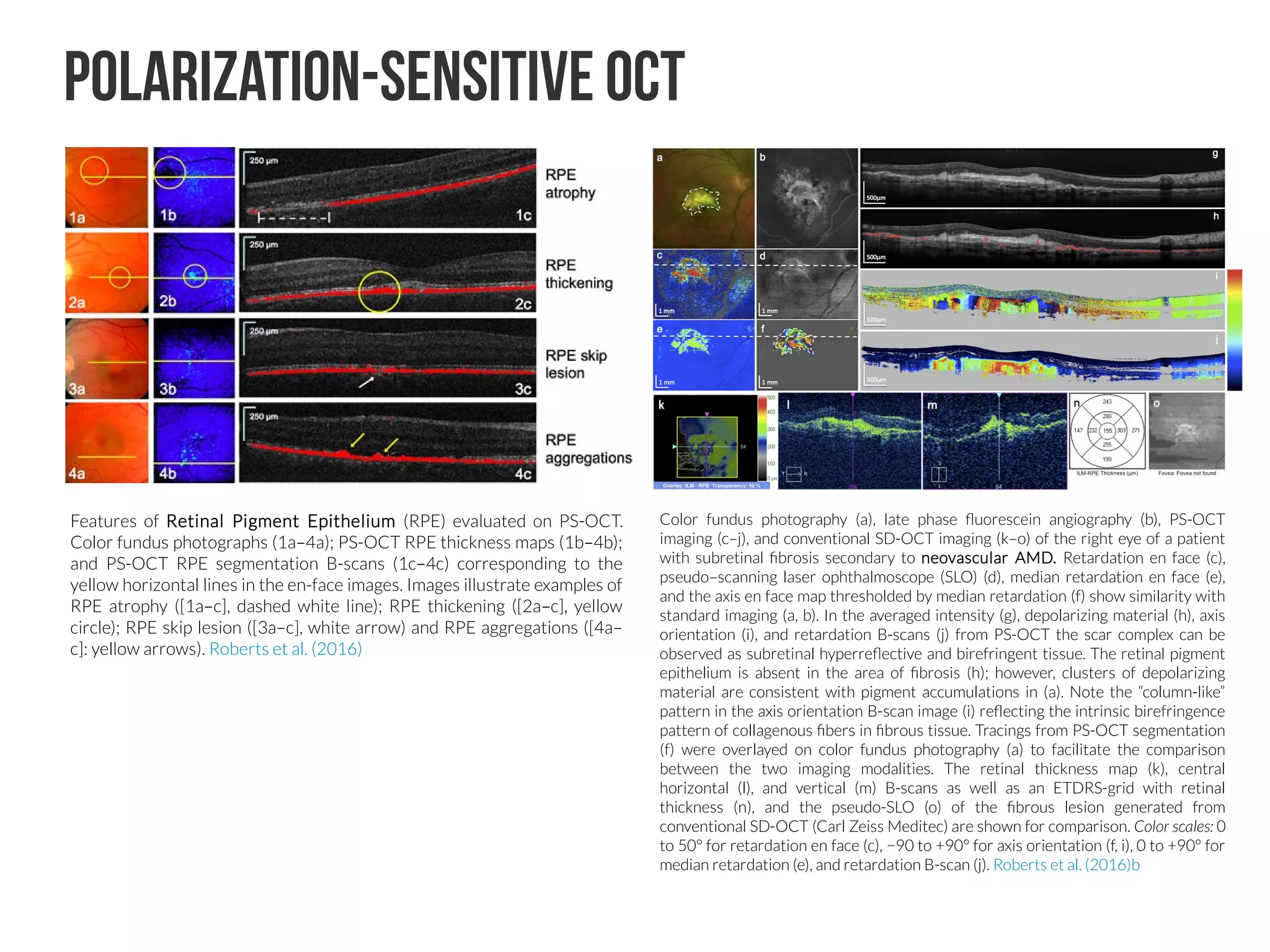 Shallow introduction for Deep Learning Retinal Image Analysis | PDF
