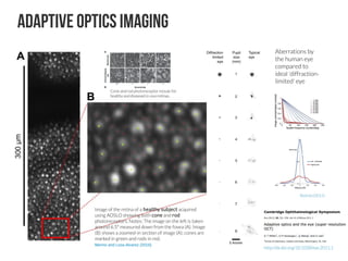 Shallow introduction for Deep Learning Retinal Image Analysis | PDF