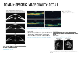 Shallow introduction for Deep Learning Retinal Image Analysis | PDF