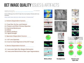 Shallow introduction for Deep Learning Retinal Image Analysis | PDF