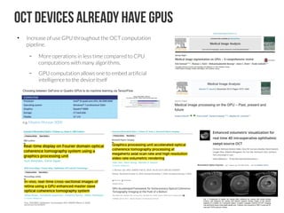 Shallow introduction for Deep Learning Retinal Image Analysis | PDF