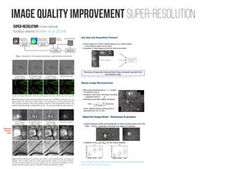 Shallow introduction for Deep Learning Retinal Image Analysis | PDF