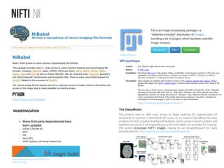 Shallow introduction for Deep Learning Retinal Image Analysis | PDF