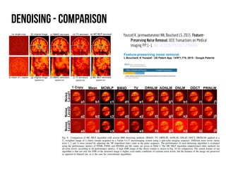 Shallow introduction for Deep Learning Retinal Image Analysis | PDF