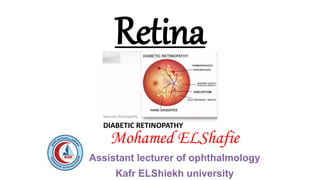 Retina
Mohamed ELShafie
Assistant lecturer of ophthalmology
Kafr ELShiekh university
 