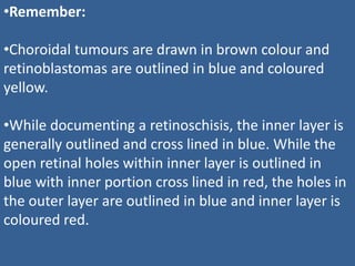 •Remember:
•Choroidal tumours are drawn in brown colour and
retinoblastomas are outlined in blue and coloured
yellow.
•While documenting a retinoschisis, the inner layer is
generally outlined and cross lined in blue. While the
open retinal holes within inner layer is outlined in
blue with inner portion cross lined in red, the holes in
the outer layer are outlined in blue and inner layer is
coloured red.
 