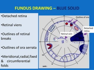 •Detached retina
•Retinal viens
•Outlines of retinal
breaks
•Outlines of ora serrata
•Meridional,radial,fixed
& circumferential
folds
Detached
retina
Retinal vein
Outline of ora
 