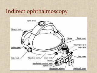 Indirect ophthalmoscopy
 