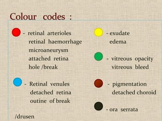 - retinal arterioles - exudate
retinal haemorrhage edema
microaneurysm
attached retina - vitreous opacity
hole /break vitreous bleed
- Retinal venules - pigmentation
detached retina detached choroid
outine of break
- ora serrata
/drusen
 