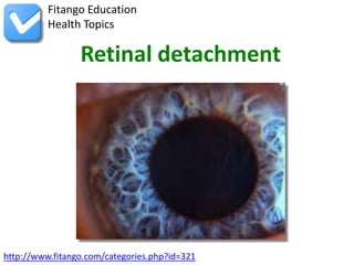 http://www.fitango.com/categories.php?id=321
Fitango Education
Health Topics
Retinal detachment
 