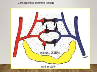Consequences of chronic leakage
 