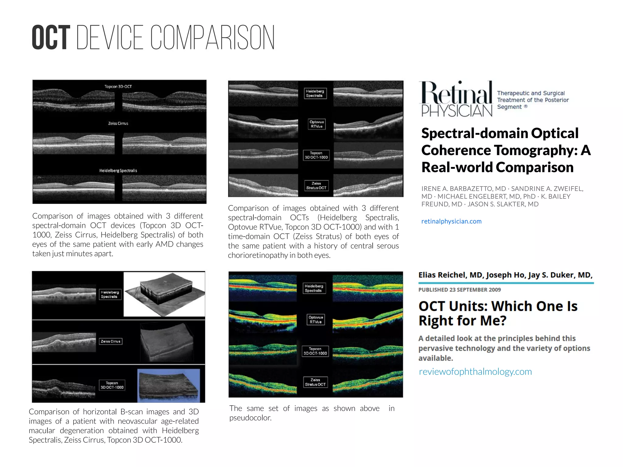 OCT Device Comparison
Comparison of images obtained with 3 different
spectral-domain OCT devices (Topcon 3D OCT-
1000, Zeiss Cirrus, Heidelberg Spectralis) of both
eyes of the same patient with early AMD changes
taken just minutes apart.
Comparison of images obtained with 3 different
spectral-domain OCTs (Heidelberg Spectralis,
Optovue RTVue, Topcon 3D OCT-1000) and with 1
time-domain OCT (Zeiss Stratus) of both eyes of
the same patient with a history of central serous
chorioretinopathy in both eyes.
The same set of images as shown above in
pseudocolor.
Comparison of horizontal B-scan images and 3D
images of a patient with neovascular age-related
macular degeneration obtained with Heidelberg
Spectralis, Zeiss Cirrus, Topcon 3D OCT-1000.
Spectral-domain Optical
Coherence Tomography: A
Real-world Comparison
IRENE A. BARBAZETTO, MD · SANDRINE A. ZWEIFEL,
MD · MICHAEL ENGELBERT, MD, PhD · K. BAILEY
FREUND, MD · JASON S. SLAKTER, MD
retinalphysician.com
reviewofophthalmology.com
 