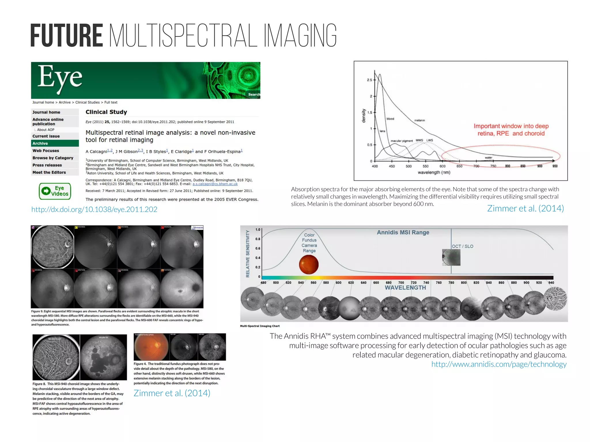 Future Multispectral Imaging
http://dx.doi.org/10.1038/eye.2011.202
Absorption spectra for the major absorbing elements of the eye. Note that some of the spectra change with
relatively small changes in wavelength. Maximizing the differential visibility requires utilizing small spectral
slices. Melanin is the dominant absorber beyond 600 nm.
Zimmer et al. (2014)
Zimmer et al. (2014)
The Annidis RHA™ system combines advanced multispectral imaging (MSI) technology with
multi-image software processing for early detection of ocular pathologies such as age
related macular degeneration, diabetic retinopathy and glaucoma.
http://www.annidis.com/page/technology
 