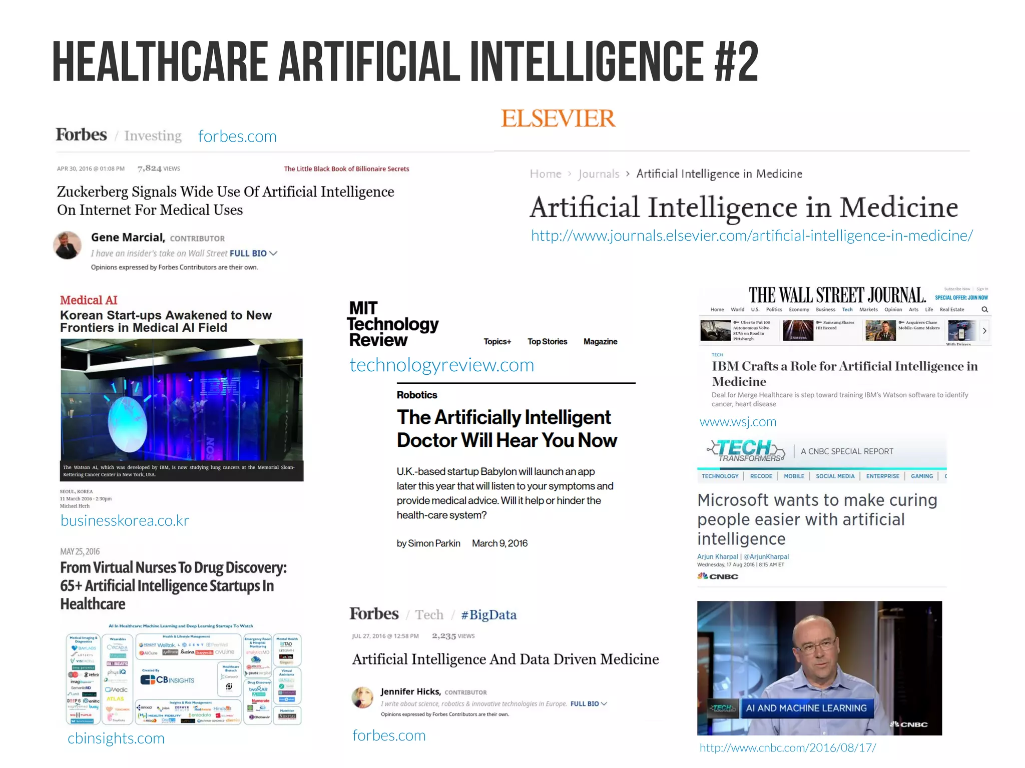 RETINAL AI Companies DeepMind #2
At a Glance
●
You may have heard of Google’s DeepMind division – which has artificial
intelligence (AI) algorithms that can beat not only Atari videogames from the 1980s,
but also the world’s best player of the world’s most complex board game, Go
●
But their AI platform has health applications too, which inspired Moorfields
Consultant Ophthalmologist, Pearse Keane, to assess its potential to automate and
transform retinal image analysis – and disease diagnostics
●
Moorfields is now sharing 1 million fundus photograph and OCT images with
DeepMind, who will train its AI algorithms to detect even the earliest signs of
disease pathology
●
Manual retinal image analysis today requires highly-trained, experienced
specialists, and takes time. AI could help both speed up the process, and prioritize
the patients who need review and treatment the earliest
Pearse Keane, a Consultant Ophthalmologist at Moorfields, initiated the
collaboration. Below is his story of how Moorfields and DeepMind got working
together, what they’re currently working on, and what’s next.: “I sent Mustafa
Suleyman a message on LinkedIn, and within a few days I was meeting him for coffee
to get the project underway.”
The AI can surely come to better conclusions if it knows the patient’s
history, demographics, treatment history and so on – how much data
will be used?
We’ve got two strands of approach to this. The first work is on the anonymized data,
which will provide more limited information. For example, we will provide the diagnosis
(say, AMD), the patient’s age, and this will be linked to a certain OCT scan, and
DeepMind’s algorithms will get to work – but there will be no patient identifiable
information. This is what we’re doing our initial analysis from. 
We’re also planning research on pseudonymized data as well. This will include additional
labels, and in particular will involve longitudinal image sets. We’ll be able to see if a patient
has had OCT scans performed at multiple visits, meaning that we can then track the
progression of the disease. We have taken extra measures to be very confident that this
won’t allow you to identify any of the patients. We’ve got ethical approval for our
pseudonymized data set, but it’s still pending UK Health Research Authority approvals.
Do you hope the AI can eventually move beyond diagnostics?
I think in the medium- to long-term we definitely hope that it will provide new scientific
insight. In the short-term we want to see if we can get accurate diagnoses, and then we’d
like to see if we can get information about disease prognosis and pathophysiology – for
example, what is the risk of converting from dry to wet AMD, and what timeline might this
occur on?
One of the really nice things about this collaboration is that DeepMind wants the
research to be clinician-led. We don’t just give them data and leave them alone to come
up with something; it’s a two-way process. They’re always looking for guidance on what
features we’re interested in, what clinical problems will have the most patient benefit if
solved, and so on.
I think what would be really interesting as a research question, is whether deep learning
could pick up features on the OCT scan that we as humans are oblivious to, even with
specialist training. I know that deep learning has been applied to things like breast cancer
histopathology, and was able to pick up new features on the microscope slide that
correlate with five-year survival of patients with breast cancer. To do something similar
would be the Holy Grail in terms of OCT retinal imaging research.
https://theophthalmologist.com/issues/0716/on-a-quest-to-find-the-holy-grail-of-imaging/
 