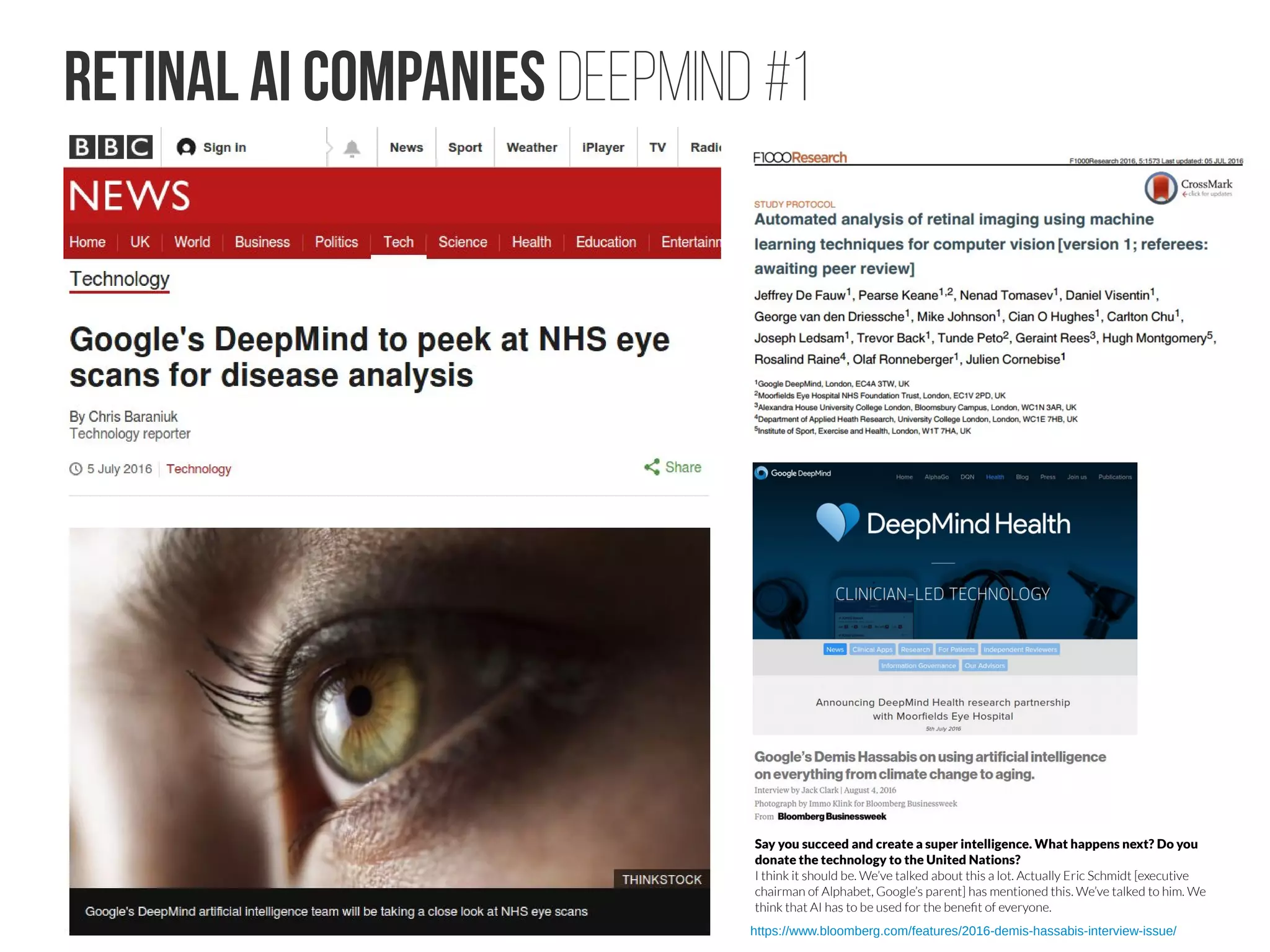 Academic Approaches
S6516 - Automatic Gradingof Eye Diseases throughDeep Learning
Apaar Sadhwani Ph.D. Candidate, Stanford University
We'll outline the development of state-of-the-art medical imaging
system using novel deep architectures that harness GPUs for
accelerated training. Trained using data from Stanford Byers Eye
Institute and Palo Alto VA Hospital, our model grades the severity of
eye diseases and localizes lesions to help screen eye patients at primary care.
At the heart of this system lies our hybrid approach to deep learning for
high resolution images -- a large convnet with millions of parameters
trained with downsized images, fused with a net trained on selected
tiles of the high-resolution image. This innovative approach involves use
of transfer learning, data augmentation, and multi-GPU systems to
identify small-scale features that are critical to detecting eye diseases.
Tags: Deep Learning & Artificial Intelligence; Medical Imaging;
Supercomputing & HPC; Press-Suggested Sessions: AI & Deep Learning
http://arxiv.org/abs/1608.01339
https://arxiv.org/abs/1603.04833
 
