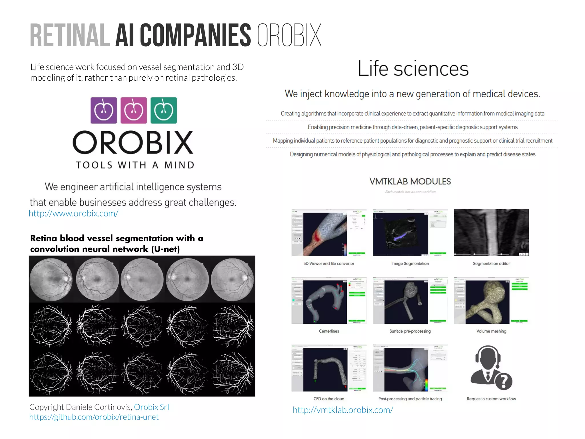 Other retinal markers for disease
Bipolar disorder
http://dx.doi.org/10.1016/j.comppsych.2016.02.005
Major depressive disorder
http://dx.doi.org/10.1016/j.comppsych.2016.02.005
Neuromyelitis optica and multiple sclerosis
http://dx.doi.org/10.1016/j.psychres.2015.07.028
Schizophrenia
http://dx.doi.org/10.1016/j.pscychresns.2011.08.011
Neurology in general
http://dx.doi.org/10.1097/WCO.0b013e328334e99b
Neurology in general #2
http://www.ncbi.nlm.nih.gov/pubmed/20065921
Huntington's disease
http://dx.doi.org/10.1002/mds.26486
Optical Coherence Tomography and Visual Field Findings in Patients With
Friedreich Ataxia
http://dx.doi.org/10.1097/WNO.0000000000000068
Retinal nerve fibre layer loss in hereditary spastic paraplegias is restricted
to complex phenotypes
http://dx.doi.org/10.1186/1471-2377-12-143
Retinal nerve fiber layer thickness in patients with essential tremor.
Retinal markers in various neurodegenerative disease
retinalphysician.com
http://dx.doi.org/10.1016/S1474-4422(16)00068-5
 