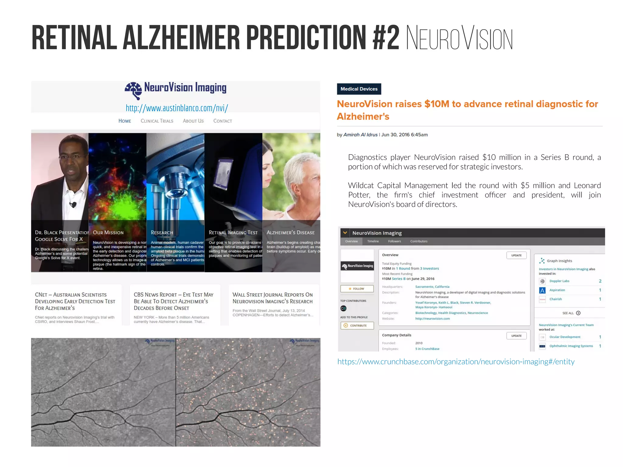 Patents for AI technology
One signal of this change is the dramatic increase in the number of companies making serious investments in Machine Learning. IBM is the
most famous example with Watson and their innovative cloud service. But Google, Amazon and Microsoft are also deeply involved. Even 
Uber just bought a whole department of strong University talent from Carnegie-Mellon. These actions are not those of crazed corporate
lemmings pouring their money off the cliff. No, not at all. The investment is increasing because finally, after decades of disappointment, Machine
Learning algorithms are solving useful problems and delivering useful results.
Patent law was designed to protect the work of inventors. Inventors are the
ones “who conceived the invention.” Patents give inventors an exclusionary
right to their particular invention. Patent protection provides a mechanism to
compensate inventors for their investment in developing the invention, e.g., by
permitting others to practice their invention for a fee.
But the rising capability and prevalence of AI seem to pose a threat to this
system. First, as discussed before, identifying the problem itself is not
patentable. In some jurisdictions, problem identification by the inventor does
not protect against a claim of obviousness when the solution combines prior
known elements.
Consider then the case where the researcher presents the AI entity with a
problem to solve. The AI entity then crafts (or “deep learns”) the solution. Who
is the inventor of that solution? Certainly not the researcher, since current
law does not credit problem identification by itself worthy of patent protection.
Furthermore, the researcher didn’t actually create or even discover the
solution (the AI did).
The arrival of IBM’s Watson and his cousins from other companies is a game
changer. The new technology affects many things including the world of
Intellectual Property. Those who hate patents anyway will likely cheer this coming
world.
With some predicting that artificial intelligence (AI) will allow a patent to be filed
and granted without human intervention within the next 25 years, WIPR
assesses the potential impact of AI on the IP landscape.
worldipreview.com
cipa.org.uk/policy-and-news
 
