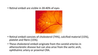 • Retinal emboli are visible in 20-40% of eyes
• Retinal emboli consists of cholesterol (74%), calcified material (15%),
platelet and fibrin (15%).
• These cholesterol emboli originate from the carotid arteries in
atherosclerotic disease but can also arise from the aortic arch,
ophthalmic artery or proximal CRA.
 