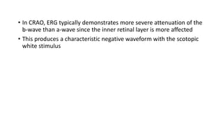 • In CRAO, ERG typically demonstrates more severe attenuation of the
b-wave than a-wave since the inner retinal layer is more affected
• This produces a characteristic negative waveform with the scotopic
white stimulus
 