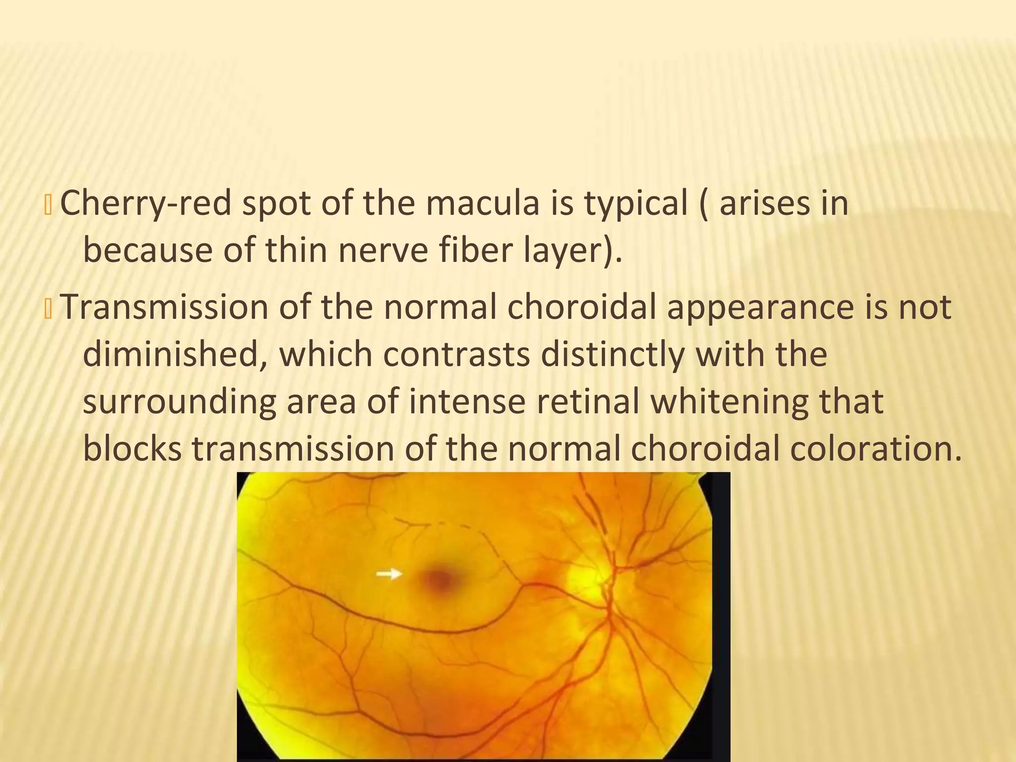 � Cherry-red spot of the macula is typical ( arises in
because of thin nerve fiber layer).
� Transmission of the normal choroidal appearance is not
diminished, which contrasts distinctly with the
surrounding area of intense retinal whitening that
blocks transmission of the normal choroidal coloration.
 