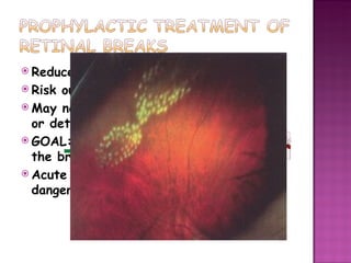Retinal breaks | PPT