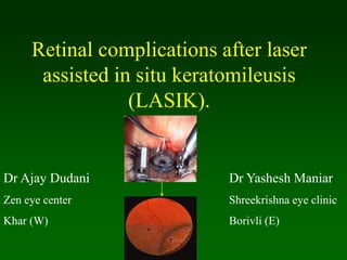 Retinal complications after laser
assisted in situ keratomileusis
(LASIK).
Dr Ajay Dudani
Zen eye center
Khar (W)
Dr Yashesh Maniar
Shreekrishna eye clinic
Borivli (E)
 