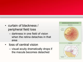 curtain of blackness / peripheral field lossdarkness in one field of vision when the retina detaches in that arealoss of central visionvisual acuity dramatically drops if the macula becomes detached