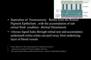 Retinal detachment | PDF