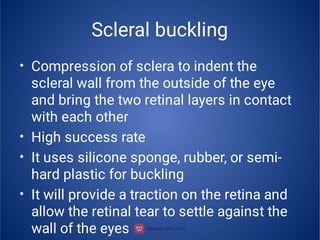 Scleral buckling
•
•
•
•
Compression of sclera to indent the
scleral wall from the outside of the eye
and bring the two retinal layers in contact
with each other
High success rate
It uses silicone sponge, rubber, or semi-
hard plastic for buckling
It will provide a traction on the retina and
allow the retinal tear to settle against the
wall of the eyes
 