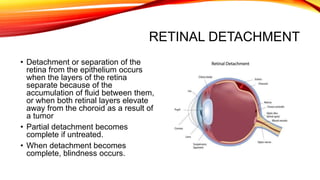 Retinal detachment | PPTX | Eye and Vision Conditions | Diseases and ...