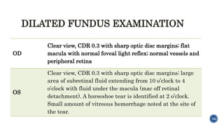 retinal detachment.pptx