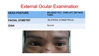 External Ocular Examination
HEAD POSTURE NO HEAD TILT, CHIN LIFT, OR FACE
TURN,
FACIAL SYMETRY BILATERAL SYMMETRICAL
Orbit Normal
 