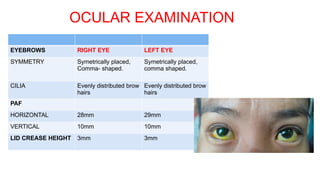 OCULAR EXAMINATION
EYEBROWS RIGHT EYE LEFT EYE
SYMMETRY Symetrically placed,
Comma- shaped.
Symetrically placed,
comma shaped.
CILIA Evenly distributed brow
hairs
Evenly distributed brow
hairs
PAF
HORIZONTAL 28mm 29mm
VERTICAL 10mm 10mm
LID CREASE HEIGHT 3mm 3mm
 