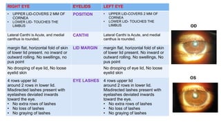 RIGHT EYE EYELIDS LEFT EYE
• UPPER LID-COVERS 2 MM OF
CORNEA
• LOWER LID- TOUCHES THE
LIMBUS
POSITION • UPPER LID-COVERS 2 MM OF
CORNEA
• LOWER LID- TOUCHES THE
LIMBUS
Lateral Canthi is Acute, and medial
canthus is rounded.
CANTHI Lateral Canthi is Acute, and medial
canthus is rounded.
margin flat, horizontal fold of skin
of lower lid present. no inward or
outward rolling. No swellings, no
pus point
LID MARGIN margin flat, horizontal fold of skin
of lower lid present. No inward or
outward rolling. No swellings, No
pus point
No drooping of eye lid, No loose
eyelid skin
No drooping of eye lid, No loose
eyelid skin
4 rows upper lid
around 2 rows in lower lid.
Misdirected lashes present with
eyelashes deviated inwards
toward the eye.
• No extra rows of lashes
• No loss of lashes
• No graying of lashes
EYE LASHES 4 rows upper lid
around 2 rows in lower lid.
Misdirected lashes present with
eyelashes deviated inwards
toward the eye.
• No extra rows of lashes
• No loss of lashes
• No graying of lashes
OD
OS
 