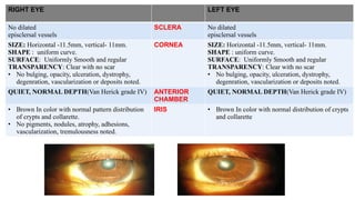 RIGHT EYE LEFT EYE
No dilated
episclersal vessels
SCLERA No dilated
episclersal vessels
SIZE: Horizontal -11.5mm, vertical- 11mm.
SHAPE : uniform curve.
SURFACE: Uniformly Smooth and regular
TRANSPARENCY: Clear with no scar
• No bulging, opacity, ulceration, dystrophy,
degenration, vascularization or deposits noted.
CORNEA SIZE: Horizontal -11.5mm, vertical- 11mm.
SHAPE : uniform curve.
SURFACE: Uniformly Smooth and regular
TRANSPARENCY: Clear with no scar
• No bulging, opacity, ulceration, dystrophy,
degenration, vascularization or deposits noted.
QUIET, NORMAL DEPTH(Van Herick grade IV) ANTERIOR
CHAMBER
QUIET, NORMAL DEPTH(Van Herick grade IV)
• Brown In color with normal pattern distribution
of crypts and collarette.
• No pigments, nodules, atrophy, adhesions,
vascularization, tremulousness noted.
IRIS • Brown In color with normal distribution of crypts
and collarette
 