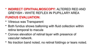 • INDIRECT OPHTHALMOSCOPY: ALTERED RED AND
GREYISH - WHITE REFLEX IN PUPILLARY AREA
FUNDUS EVALUATION:
• Vitreous was Transparent
• Both fundus shows balloning with fluid collection within
retina temporal to macula
• Convex elevation of retinal layer with presence of
vascular network.
• No traction band noted, no retinal foldings or tears noted.
 