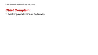 Case Reviewed in OPD on 31st Dec, 2024
Chief Complain:
• Mild improved vision of both eyes
 
