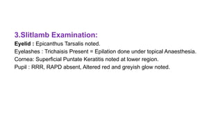 3.Slitlamb Examination:
Eyelid : Epicanthus Tarsalis noted.
Eyelashes : Trichaisis Present = Epilation done under topical Anaesthesia.
Cornea: Superficial Puntate Keratitis noted at lower region.
Pupil : RRR, RAPD absent, Altered red and greyish glow noted.
 
