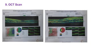 9. OCT Scan
 