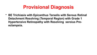 Provisional Diagnosis
• BE Trichiasis with Epicanthus Tarsalis with Serous Retinal
Detachment Resolving (Temporal Region) with Grade 1
Hypertensive Retinopathy with Resolving seroius Pre-
eclampsia.
 