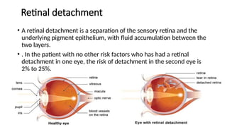 Retinal detachment
• A retinal detachment is a separation of the sensory retina and the
underlying pigment epithelium, with fluid accumulation between the
two layers.
• . In the patient with no other risk factors who has had a retinal
detachment in one eye, the risk of detachment in the second eye is
2% to 25%.
 